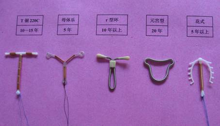 最新节育环图片展示及其步骤指南