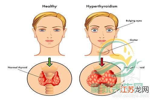 小明战胜甲亢的奇妙旅程,最新治疗与友情的力量