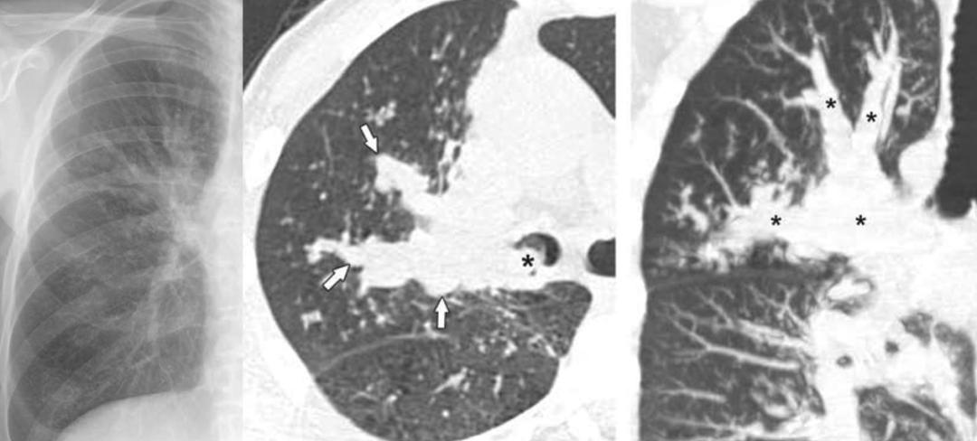 高科技重塑生活,支扩最新智能变革体验报告