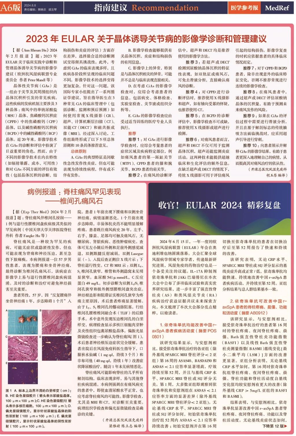 痛风最新研究揭秘，未来趋势预测与突破（2025版）✨